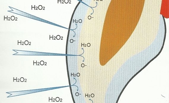 Επαγγελματική Λεύκαση Των Δοντιών
