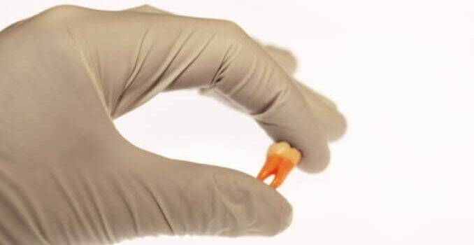 Τι Σημαίνει Πολύ Αργά Για Ένα Δόντι ? Τι Σημαίνει Πολύ Αργά Για Ένα Δόντι ?