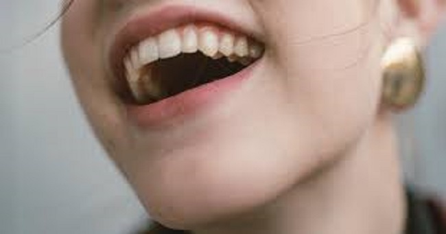 Inlay Onlay – Η Διαφορά Μεταξύ Της  Έμφραξης Και Των Inlay Onlay