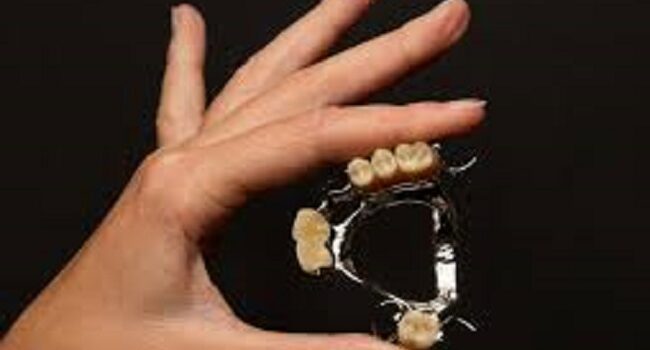 “Μηχανάκια” Κινητές  Μερικές Προσθετικές Αποκαταστάσεις.