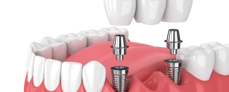 “ΦΡΟΝΤΙΔΑ” ΕΜΦΥΤΕΥΜΑΤΩΝ. “ΦΡΟΝΤΙΔΑ” ΕΜΦΥΤΕΥΜΑΤΩΝ.