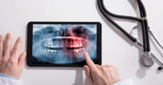 Το Δόντι Μπορεί Να Διατηρηθεί Ακόμη Και Με Την Παρουσία Πολλαπλών Γενικών Παθήσεων Και Φαρμακευτική Αγωγής?