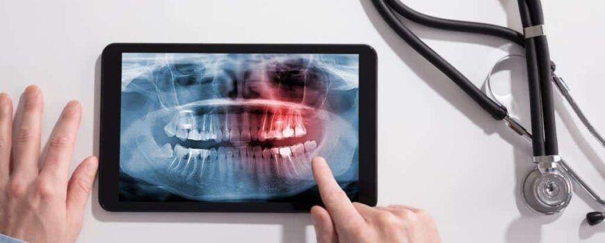 Το Δόντι Μπορεί Να Διατηρηθεί Ακόμη Και Με Την Παρουσία Πολλαπλών Γενικών Παθήσεων Και Φαρμακευτική Αγωγής? Το Δόντι Μπορεί Να Διατηρηθεί Ακόμη Και Με Την Παρουσία Πολλαπλών Γενικών Παθήσεων Και Φαρμακευτική Αγωγής?